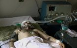 Tiflisdə keçmiş nazir müavininə sui-qəsd oldu: 1 ölü, 1 yaralı