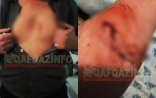 Ağsuda əlili ölümünə döydülər – FOTOLAR