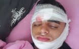 Bakıda 17 yaşlı oğlan qız üstündə ölümcül döyüldü — FOTOLAR