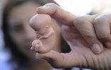 Azərbaycanda selektiv abort qadağan olunur