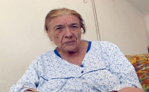 Hər iki ayağı kəsilən qadından pis xəbər
