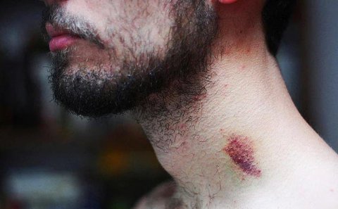 DİQQƏT! Öpüşmə zamanı bu hərəkət ölümə səbəb olur (FOTO)