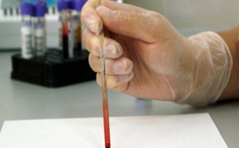 Donorların verdiyi qanın miqdarı artıb - Azərbaycanda