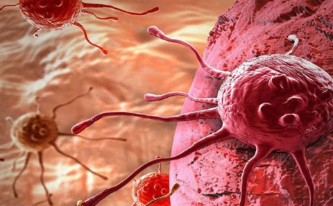 Qorxunc statistika: Ötən il Azərbaycanda 105 uşaq xərçəngdən ölüb