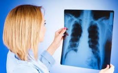 Son aylarda 211 uşaq vərəmə yoluxub - Azərbaycanda