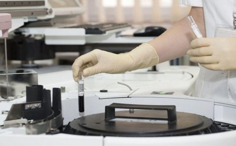 Yeni ölümcül epidemiya yayıla bilər - Alimlərdən xəbərdarlıq