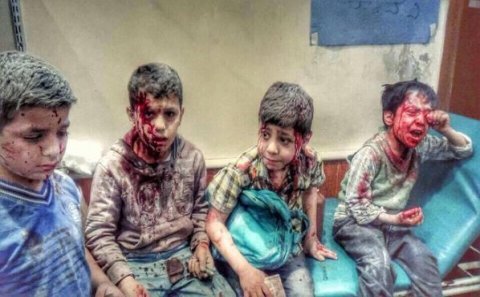 Rusiya və Əsədin bombardman etdiyi Türkmən Dağı bölgəsindən QƏTLİAM FOTOLARI (+18)