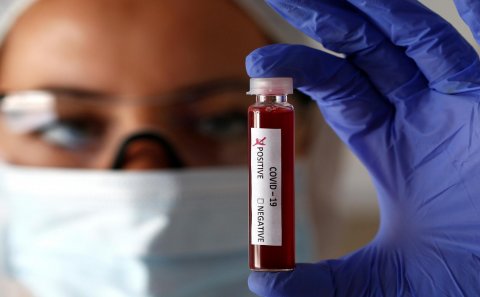 Azərbaycanda daha 49 nəfər koronavirusa yoluxdu, 62 nəfər sağaldı
