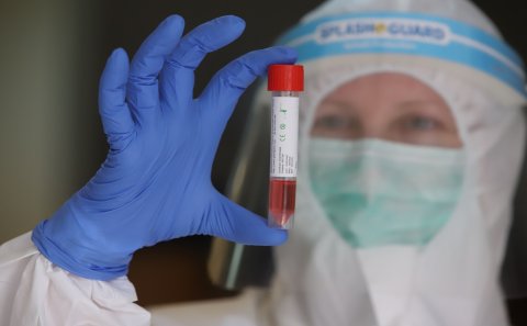 Azərbaycanda daha 38 nəfər koronavirusa yoluxub, 42 nəfər sağalıb