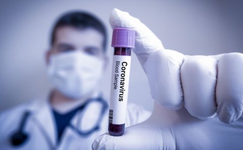 COVID-19-un yeni gözlənilməz simptomu AŞKARLANDI