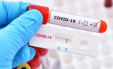 Azərbaycanda koronavirusa yoluxanların sayı azaldı