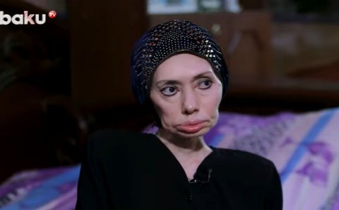 Ayna Sultanovanın nəticəsi: “Erməni tibb bacısı məni əlil etdi” – VİDEO