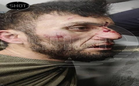 Moskvadakı terrorda şübhəli bilinənlər belə həbs edildi –Saxlanılan zaman çəkilən FOTOLAR